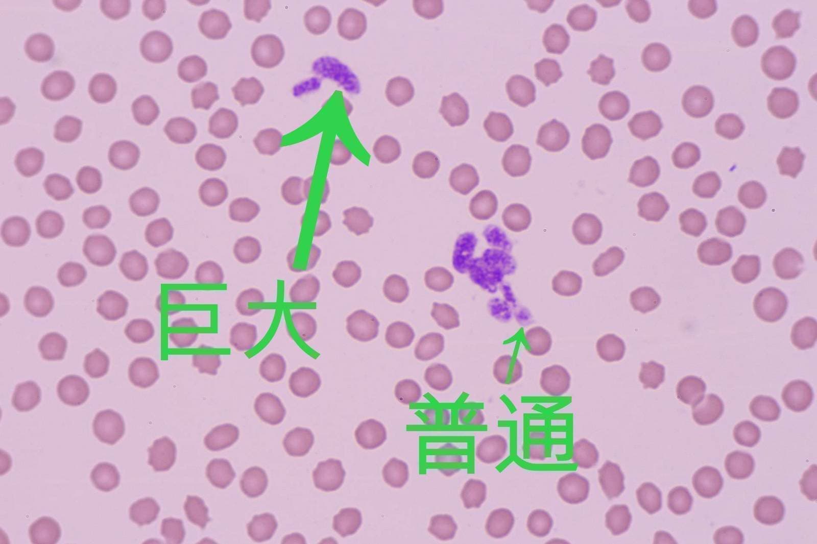 血小板